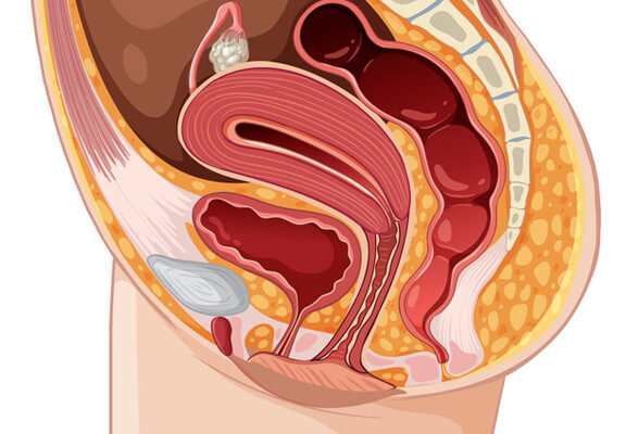 Pelvic Organ Prolapse: Symptoms, Causes, and Treatment Options