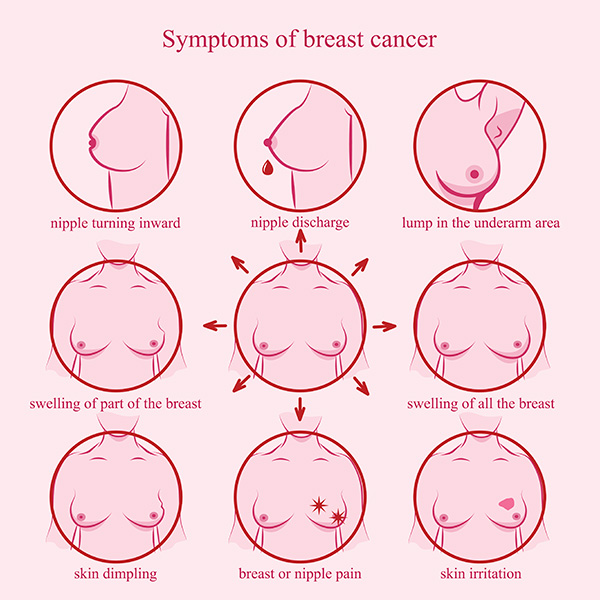 Images of each symptom of breast cancer including nipple turning inward, nipple discharge, lump in the underarm area, swelling of part of the breast, swelling of all of the breast, skin dimpling, breast or nipple pain, and skin irritation.