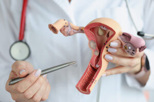 Gynecologist showing where the 5 gynecologic cnacers reside in female anatomy